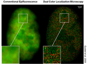 The difference between conventional and superresolution microscopy